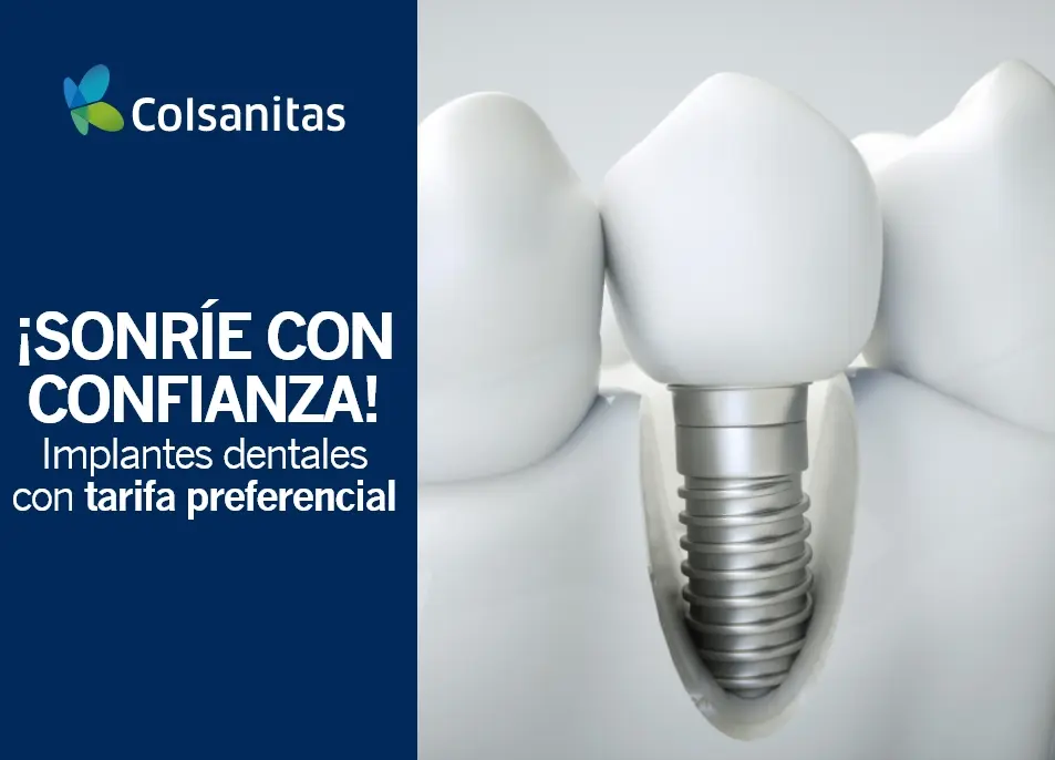 clinicas-dentales-colsanitas-implantes15dto